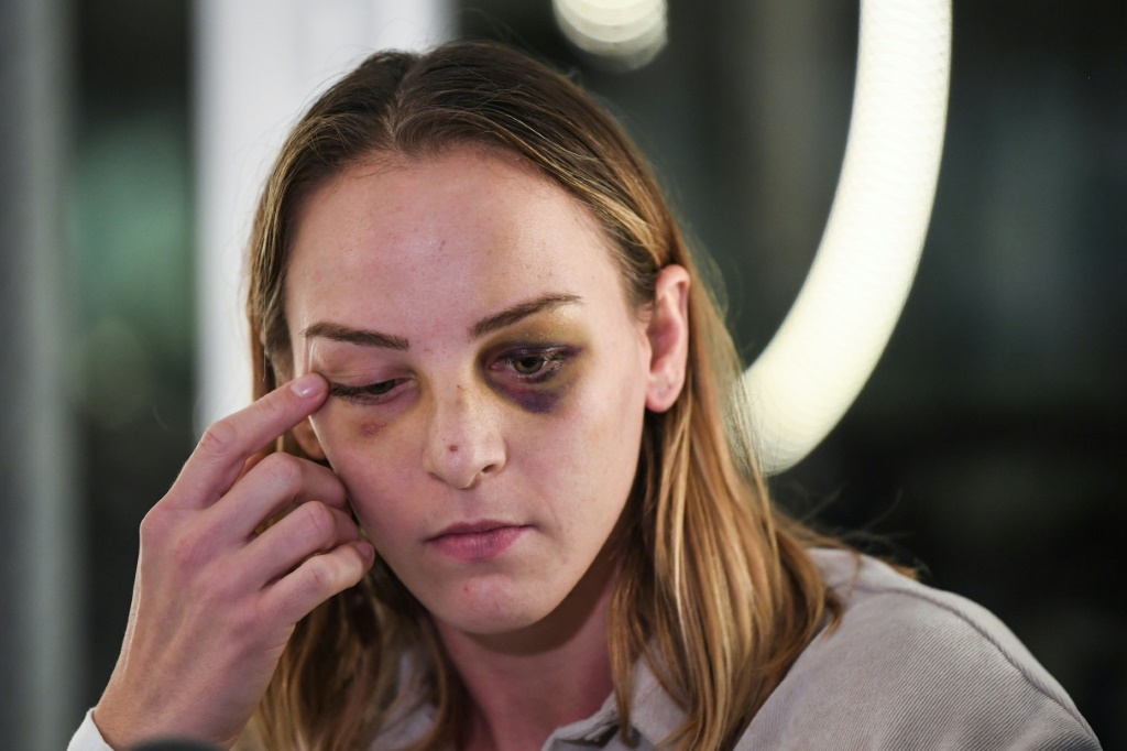 La judoka Margaux Pinot visage tuméfié lors d'un point presse à Paris, le 2 décembre 2021