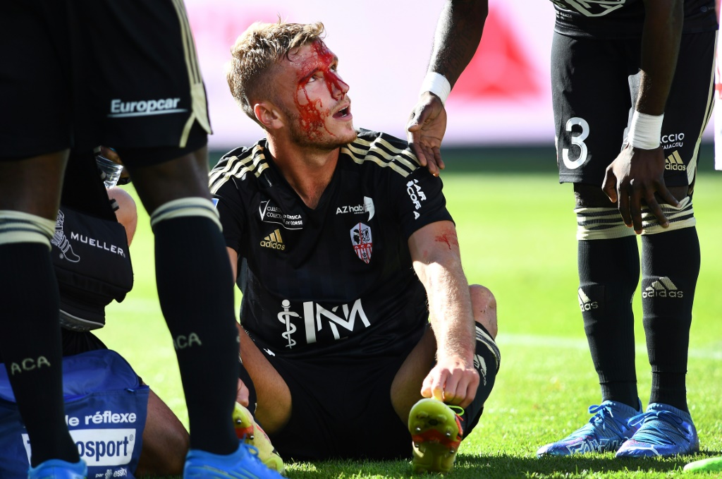 Le défenseur de Brest Noah Fadiga, blessé, est évacué sur une civière lors du match contre Ajaccio, le 18 septembre 2022