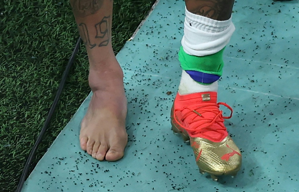 Photo de la cheville gonflée de l'attaquant brésilien Neymar prise alors qu'il quitte le terrain à la fin du match du Mondial-2022 contre la Serbie au stade de Lusail, le 24 novembre 2022
